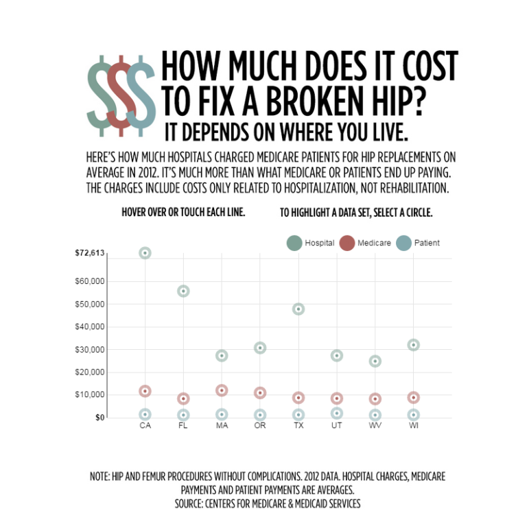 broken hip interactive cost graphic