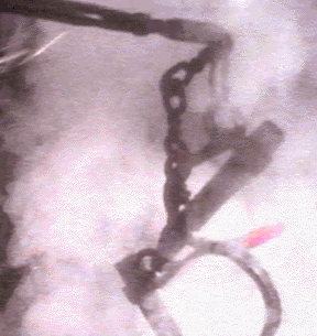 Newly shaped shackles emerge from steam